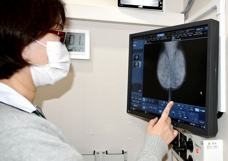 乳がん検診精度ＵＰへ画像デジタル化