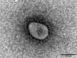 新型コロナウイルスのオミクロン株の電子顕微鏡写真（国立感染症研究所提供）
