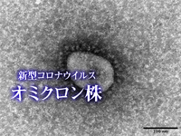 国内でオミクロン株派生型「BA.4」「BA.5」感染者を初確認　成田空港に到着した男性3人、厚生労働省が発表