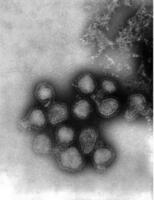 Ａ型インフルエンザウイルスの電子顕微鏡写真（米疾病対策センター提供）